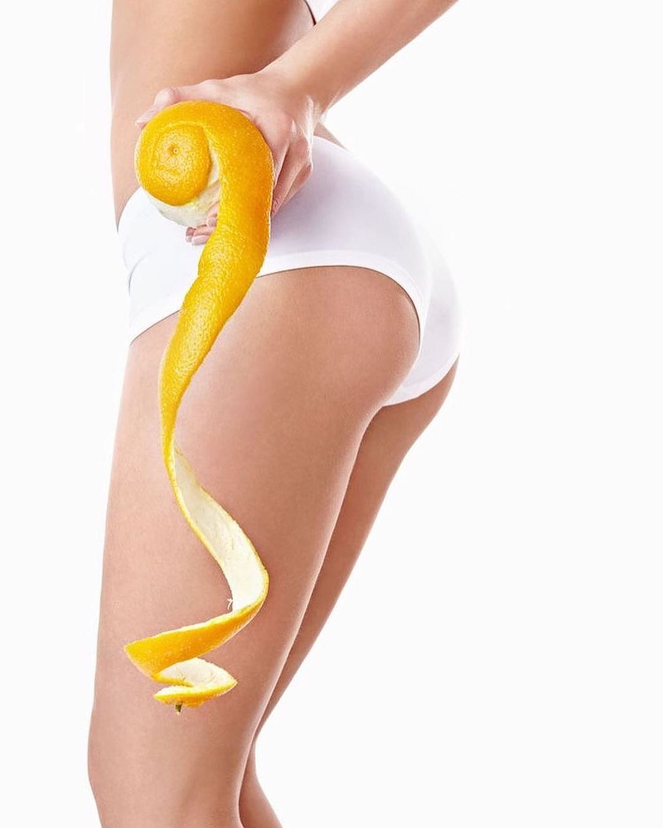 رفع سلولیت پوست پرتقالی مداستارشاپ