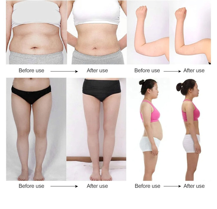 دستگاه کویتیشن آراف | لاغری موضعی، سفتکننده و جوانسازی پوست